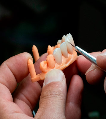 laboratoio-dental